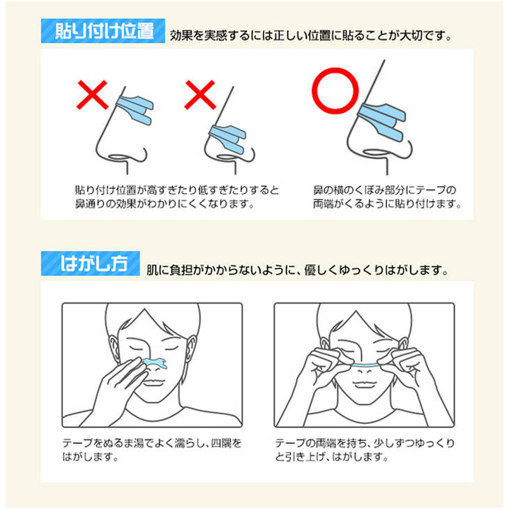 鼻腔拡張テープ X30 Pt ムラウチドットコム